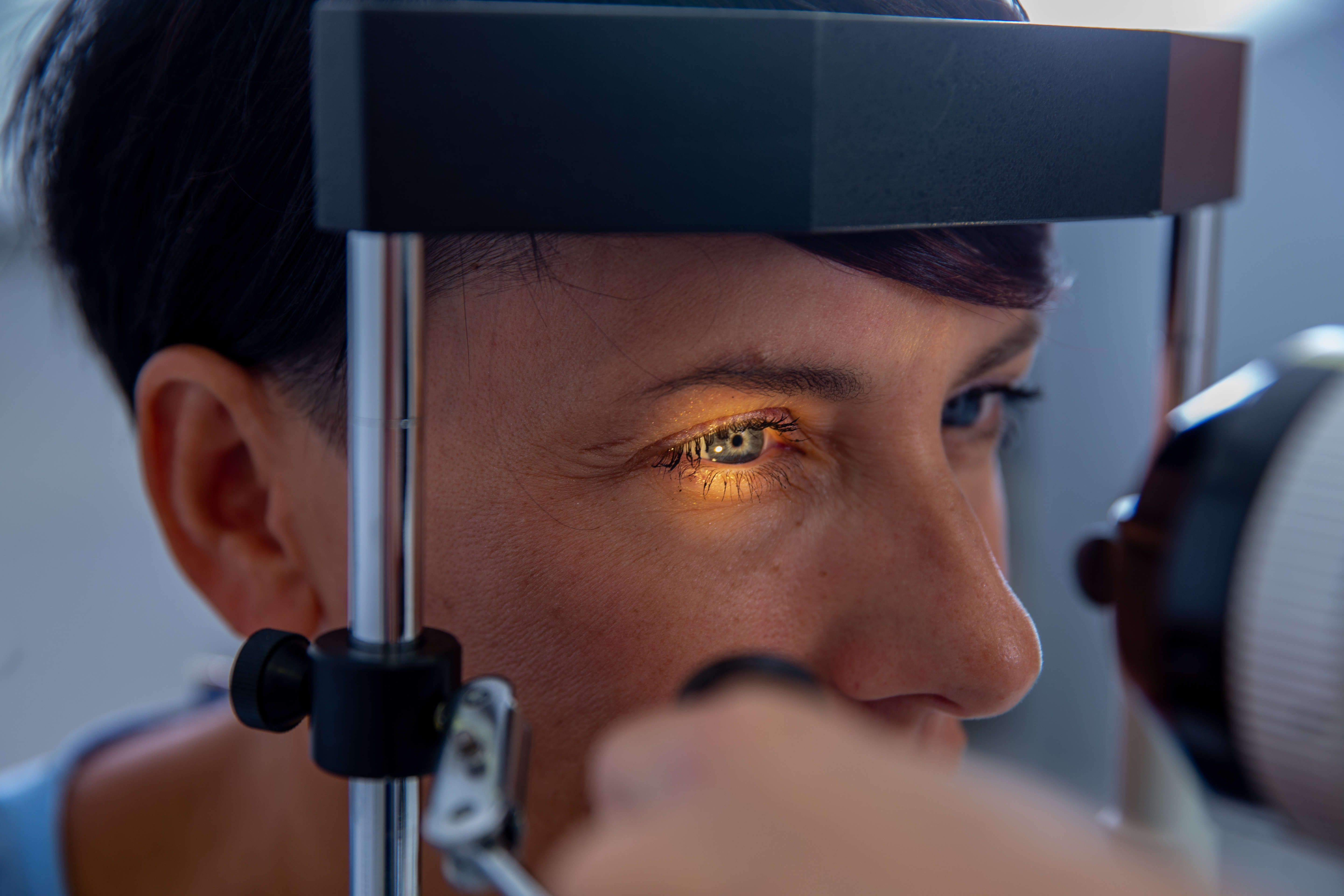 Have you heard of keratoconus? Here’s some information about this eye disease and about the effective corneal cross-linking treatment Horizon provides. 