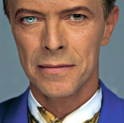 david bowie heterochromia